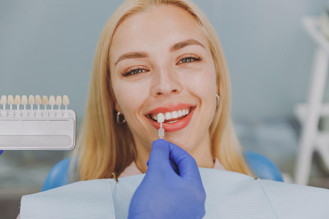 How To Take Care of Your Dental Veneers