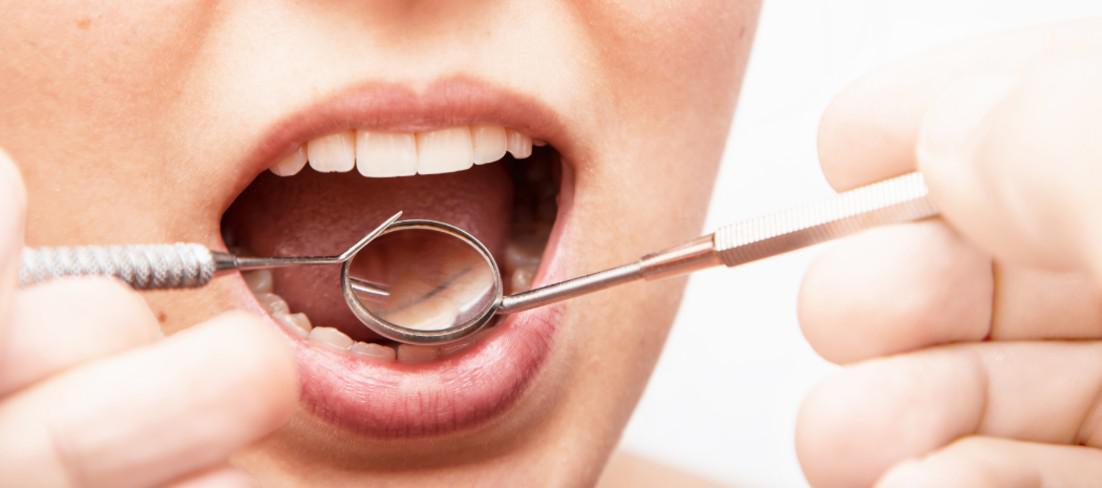 5 Home Remedies to Fight Gum Disease