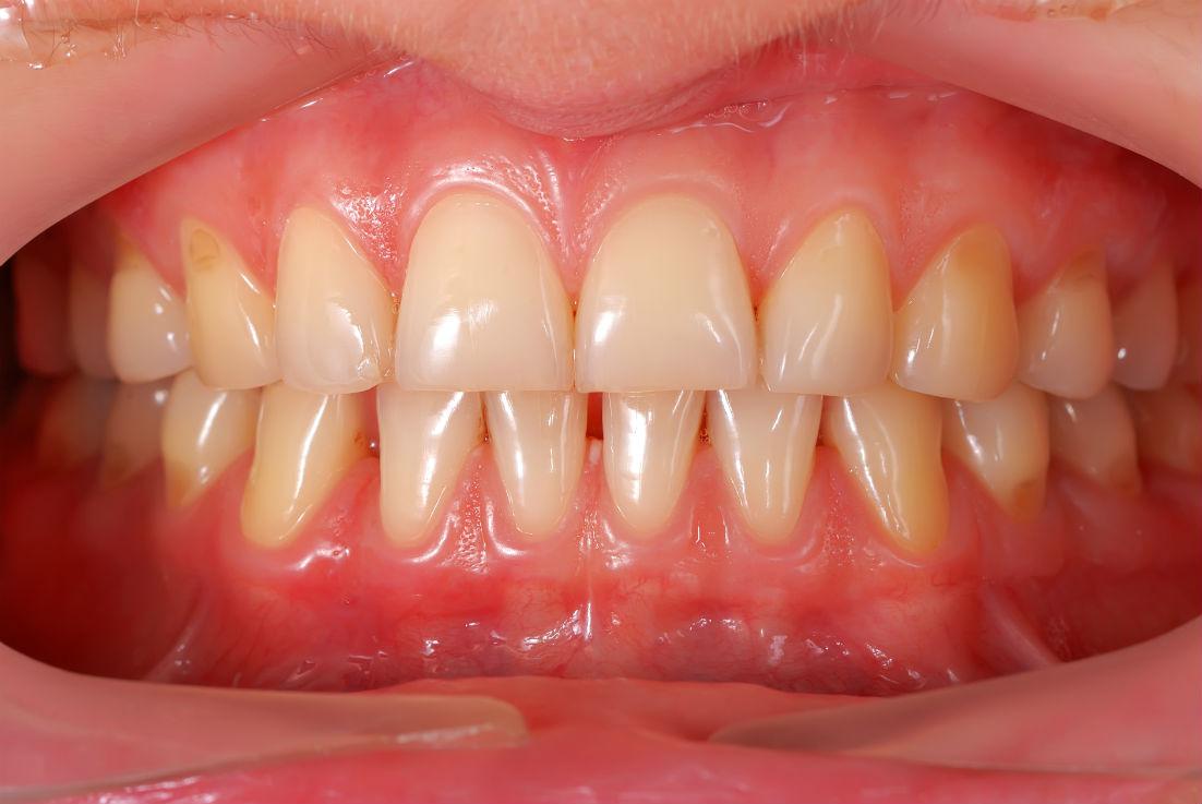 Elementary Systems Of Gums And Teeth – Basics For Consideration ...