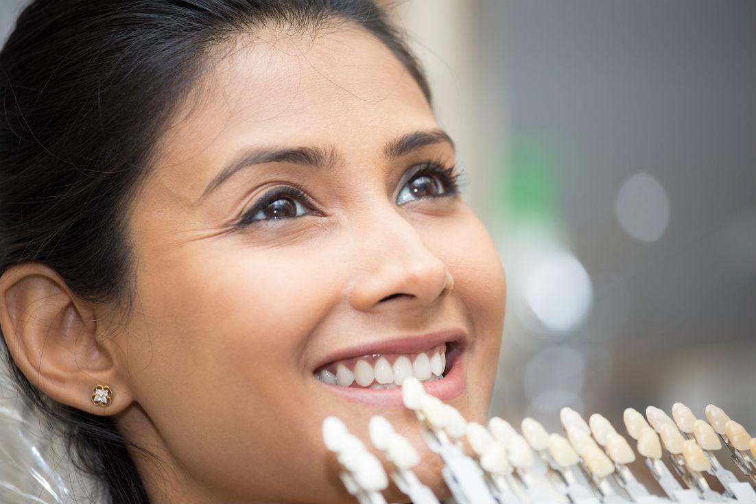 What are the Differences Between Dental Bonding and Veneers?