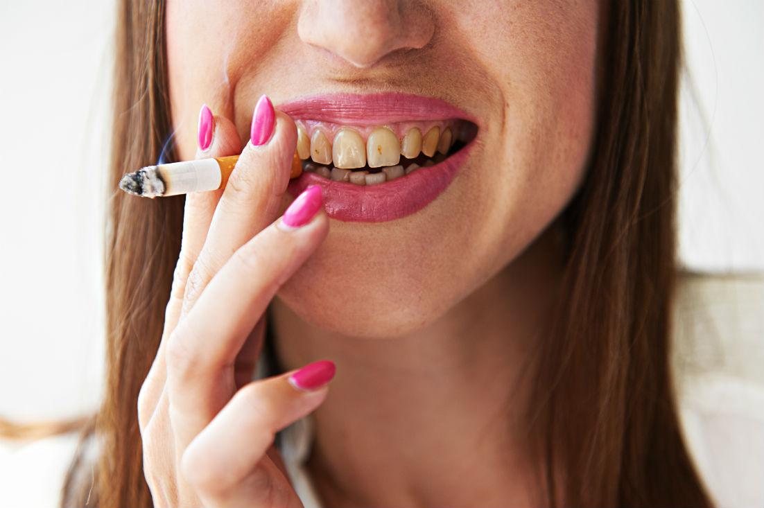 What Does Smoking Do to Your Teeth?